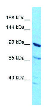 Anti-ABCF1 (N-terminal) antibody produced in rabbit affinity isolated antibody