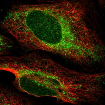 Anti-HACD3 antibody produced in rabbit Prestige Antibodies&#174; Powered by Atlas Antibodies, affinity isolated antibody