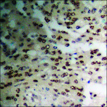 抗-磷酸-TIE2 (pTyr1108) 兔抗 affinity isolated antibody