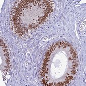 Anti-FAM169A antibody produced in rabbit Prestige Antibodies® Powered by Atlas Antibodies, affinity isolated antibody, buffered aqueous glycerol solution