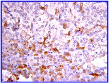 抗JAK2抗体，克隆8E10.2 clone 8E10.2, Upstate®, from mouse