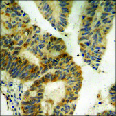 Anti-phospho-CDC2 (pThr161) antibody produced in rabbit affinity isolated antibody