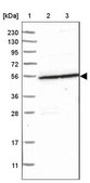 Anti-S100PBP antibody produced in rabbit Prestige Antibodies® Powered by Atlas Antibodies, affinity isolated antibody, buffered aqueous glycerol solution