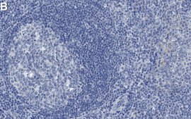 Anti-Ki-67 Antibody, clone Ki-S5 ZooMAb® Mouse Monoclonal recombinant, expressed in HEK 293 cells
