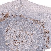 Monoclonal Anti-Irf4 Antibody Produced In Mouse Prestige Antibodies® Powered by Atlas Antibodies, clone CL14615, affinity isolated antibody, buffered aqueous glycerol solution