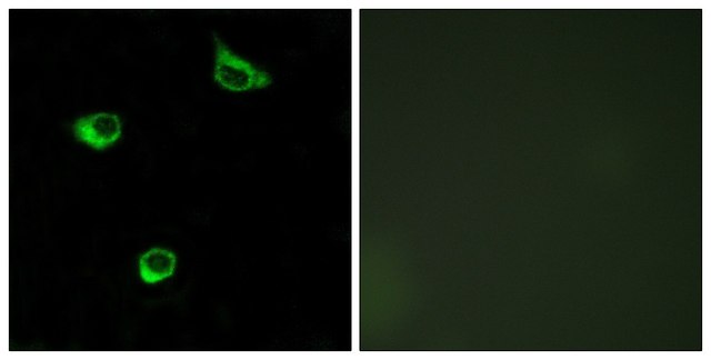 Anti-FZD6 antibody produced in rabbit affinity isolated antibody