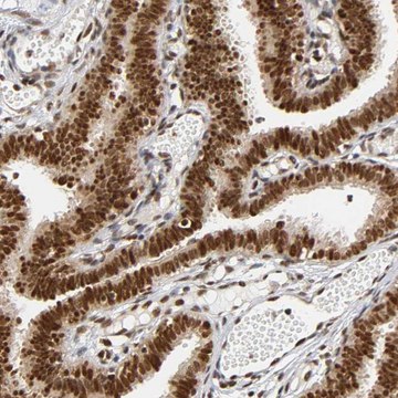 Anti-RNF122 antibody produced in rabbit Prestige Antibodies&#174; Powered by Atlas Antibodies, affinity isolated antibody, buffered aqueous glycerol solution