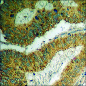 Anti-phospho-IKK-α/β (pSer180/181) antibody produced in rabbit affinity isolated antibody