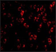 Anti-CTRP4 (ab1) antibody produced in rabbit affinity isolated antibody, buffered aqueous solution