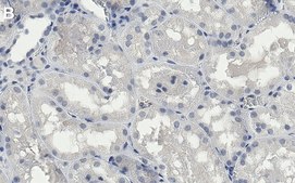 Anti-Sulfotyrosine Antibody, clone Sulfo-1C-A2 ZooMAb® Mouse Monoclonal recombinant, expressed in HEK 293 cells