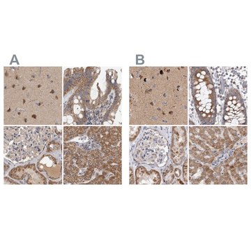 Anti-SCO1 antibody produced in rabbit Prestige Antibodies&#174; Powered by Atlas Antibodies, affinity isolated antibody, buffered aqueous glycerol solution, Ab2