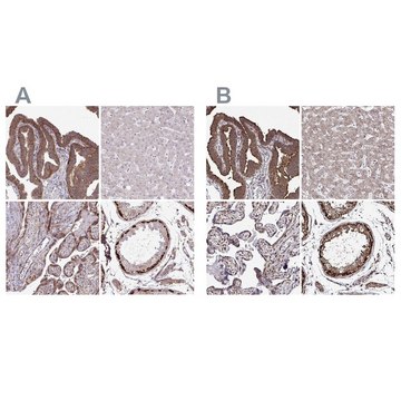 Anti-FMR1 antibody produced in rabbit Prestige Antibodies&#174; Powered by Atlas Antibodies, affinity isolated antibody, buffered aqueous glycerol solution