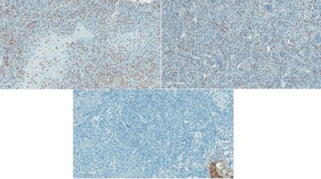 Anti-Histone H3 Antibody, K36M mutant from rabbit, purified by affinity chromatography