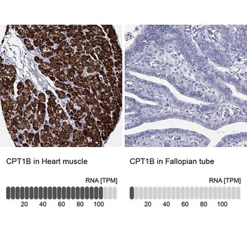 Anti-CPT1B antibody produced in rabbit Prestige Antibodies&#174; Powered by Atlas Antibodies, affinity isolated antibody, buffered aqueous glycerol solution