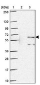 Anti-ZNF34 antibody produced in rabbit Prestige Antibodies® Powered by Atlas Antibodies, affinity isolated antibody, buffered aqueous glycerol solution