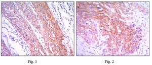 Anti-HK2 Antibody, clone 3D3 ascites fluid, clone 3D3, from mouse