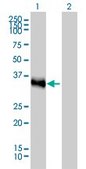 Monoclonal Anti-CRX antibody produced in mouse clone 4G11, purified immunoglobulin, buffered aqueous solution