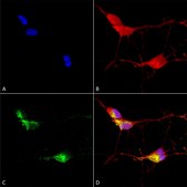 Monoclonal Anti-TRPV3 antibody produced in mouse clone S15-4, 1 mg/mL, purified immunoglobulin