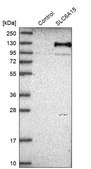 Anti-SLC6A15 antibody produced in rabbit Prestige Antibodies® Powered by Atlas Antibodies, affinity isolated antibody, buffered aqueous glycerol solution