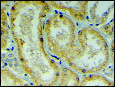 Anti-DNAJB9 (C-terminal) antibody produced in goat affinity isolated antibody, buffered aqueous solution