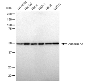 Anti Annexin A7 Antibody, clone 23GB1895, Rabbit Monoclonal clone 23GB1895, recombinant rabbit monoclonal, expressed in HEK293 cells