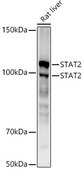 [KO Validated]Anti-STAT2 Antibody, clone 4A5P8, Rabbit Monoclonal