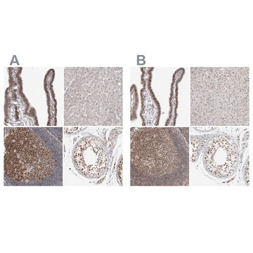 Anti-MSH6 antibody produced in rabbit Prestige Antibodies&#174; Powered by Atlas Antibodies, affinity isolated antibody, buffered aqueous glycerol solution, ab1