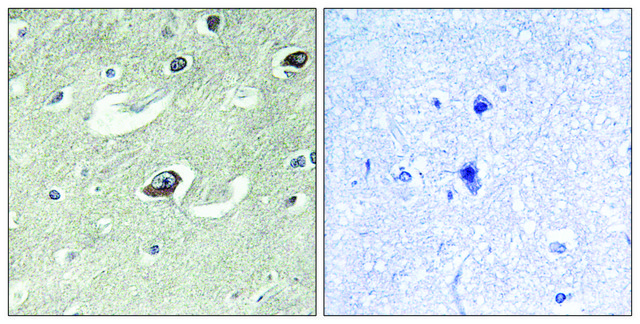 Anti-KIF20A antibody produced in rabbit affinity isolated antibody