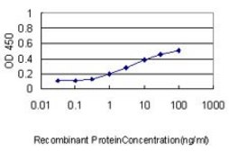 Monoclonal Anti-ATP7B antibody produced in mouse clone 3E10, purified immunoglobulin, buffered aqueous solution