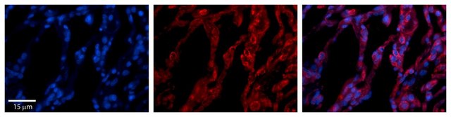 Anti-TAP1 antibody produced in rabbit affinity isolated antibody