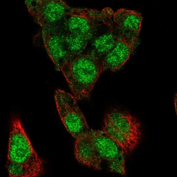 Anti-MLXIPL antibody produced in rabbit Prestige Antibodies&#174; Powered by Atlas Antibodies, affinity isolated antibody