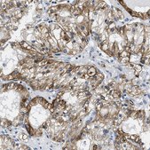 Anti-ZDHHC23 antibody produced in rabbit Prestige Antibodies® Powered by Atlas Antibodies, affinity isolated antibody, buffered aqueous glycerol solution
