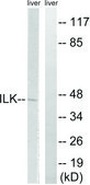 Anti-ILK antibody produced in rabbit affinity isolated antibody