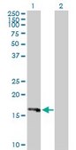 Anti-HRASLS3 antibody produced in rabbit purified immunoglobulin, buffered aqueous solution