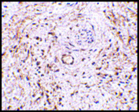 Anti-TEM5 antibody produced in rabbit affinity isolated antibody