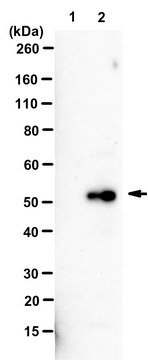 Anti-Adenovirus 5 Packaging protein IVa2