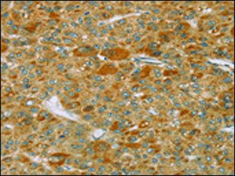 Anti-TP53I11 affinity isolated antibody