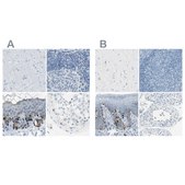 Anti-DCT antibody produced in rabbit Prestige Antibodies® Powered by Atlas Antibodies, affinity isolated antibody, buffered aqueous glycerol solution