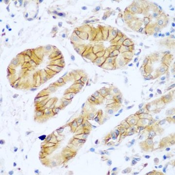 Anti-NCAM1/CD56 antibody produced in rabbit