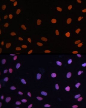 Anti-RB antibody produced in rabbit