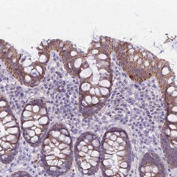 Anti-RNF170 antibody produced in rabbit Prestige Antibodies&#174; Powered by Atlas Antibodies, affinity isolated antibody, buffered aqueous glycerol solution