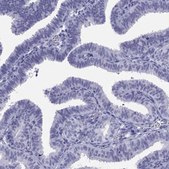 Anti-LYAR antibody produced in rabbit Prestige Antibodies® Powered by Atlas Antibodies, affinity isolated antibody, buffered aqueous glycerol solution