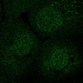 Anti-SEC14L2 antibody produced in rabbit Prestige Antibodies® Powered by Atlas Antibodies, affinity isolated antibody, buffered aqueous glycerol solution