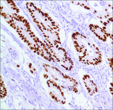 Anti-P53 antibody, Rabbit monoclonal clone SP5, recombinant, expressed in proprietary host, tissue culture supernatant