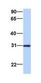 Anti-MBNL2 antibody produced in rabbit affinity isolated antibody