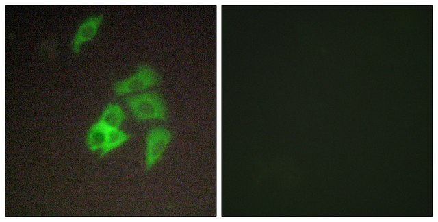 Anti-ST14, N-Terminal antibody produced in rabbit affinity isolated antibody