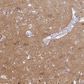 Anti-PPFIA4 antibody produced in rabbit Prestige Antibodies® Powered by Atlas Antibodies, affinity isolated antibody, buffered aqueous glycerol solution