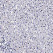 Anti-SLC30A8 Prestige Antibodies® Powered by Atlas Antibodies, affinity isolated antibody