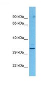 Anti-SULT1B1, (N-terminal) antibody produced in rabbit affinity isolated antibody