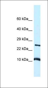 Anti-VAMP8 antibody produced in rabbit affinity isolated antibody